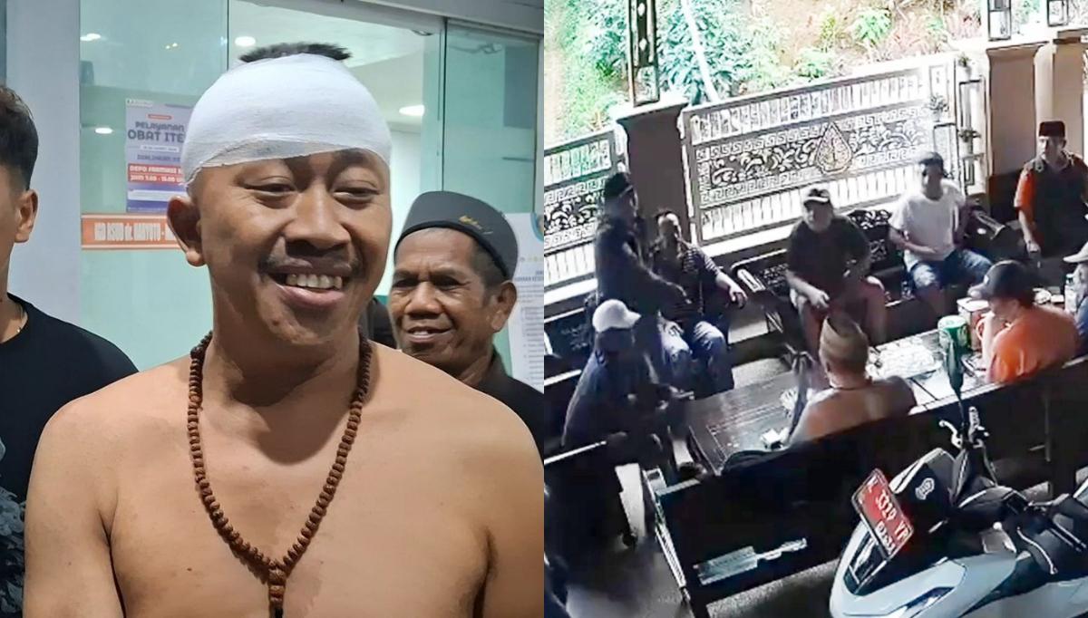 Tetap-Bisa-Senyum-usai-Dibacok-Kades-Pakel-Ajak-Pelaku-Pengeroyokan-Sholawat-Bareng-Tolak-Penjara.jpg