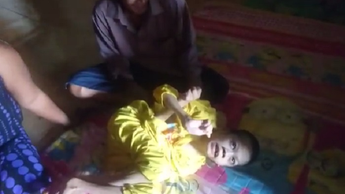 anak-penderita-polio_20160601_112109.jpg