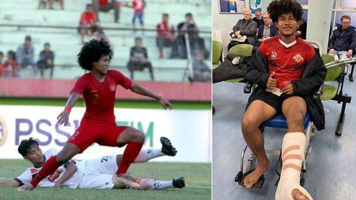 Sudah Pulih dari Cedera, Kenapa Bagus Kahfi Tak Dipanggil Shin Tae-yong ke TC Virtual Timnas U-19?