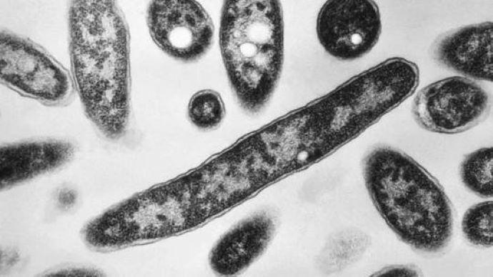 bakteri-legionella-pneumophila.jpg