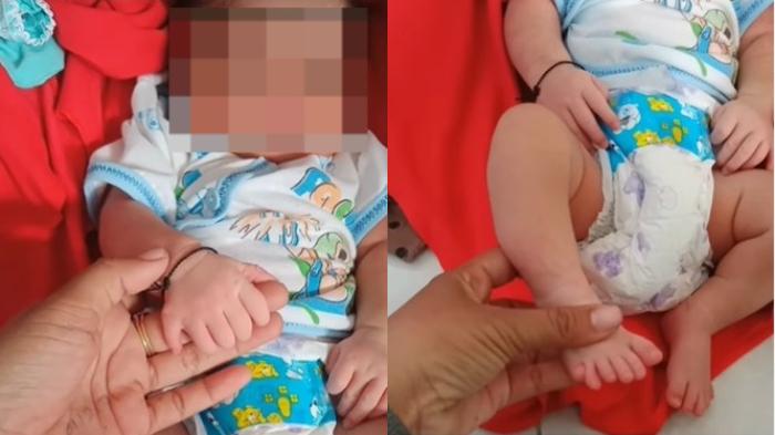 bayi-di-madura-miliki-total-24-jari.jpg