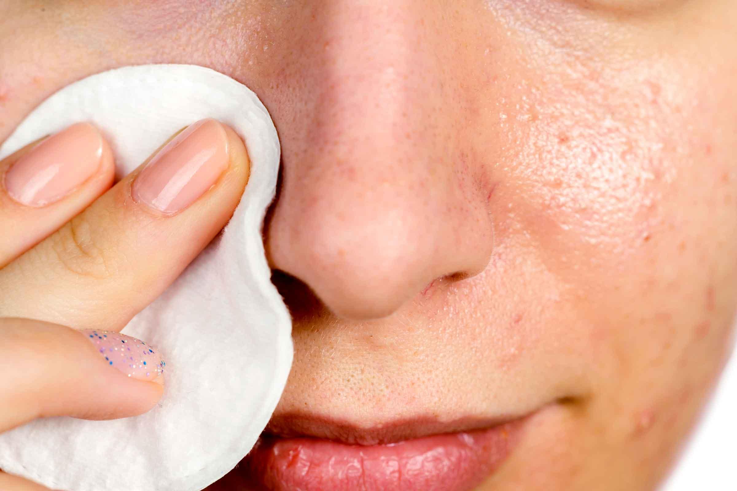 cara-menghilangkan-komedo-dengan-baby-oil.jpg