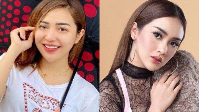 Iis Dahlia Cerita Masa Lalu Chacha Sherly, Cita Citata Bersikap dan Bertemu, Ini yang Dibicarakan