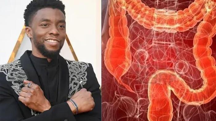 chadwick-boseman-meninggal-dunia-karena-kanker-usus-besar.jpg