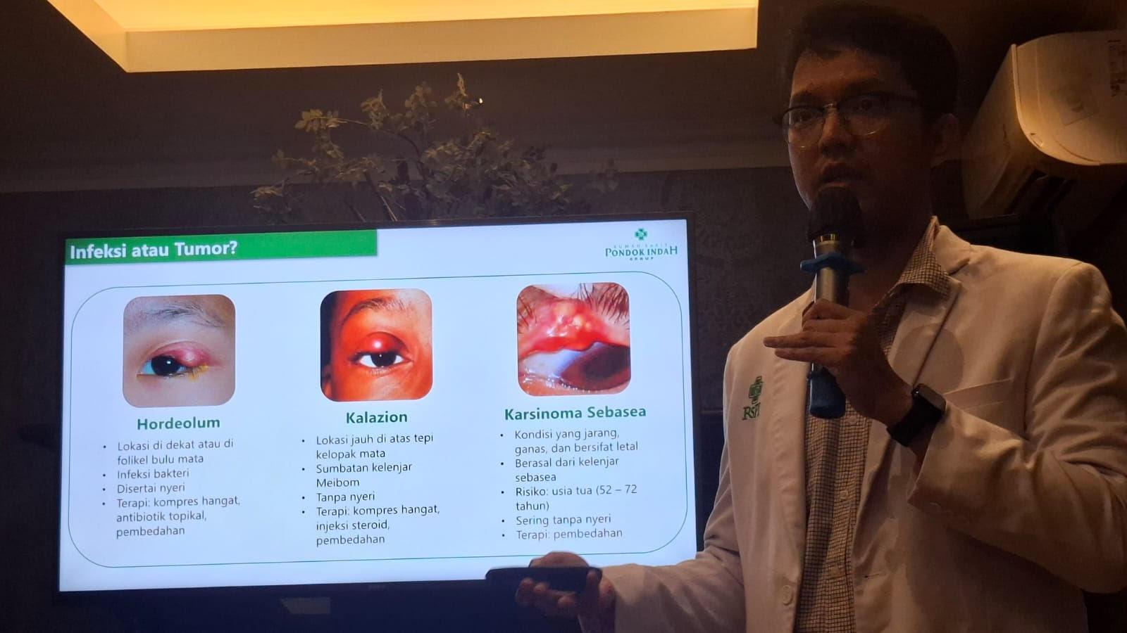 Jangan Anggap Sepele Bintitan Berulang, Dokter Ungkap Bisa Jadi Tanda Penyakit Serius