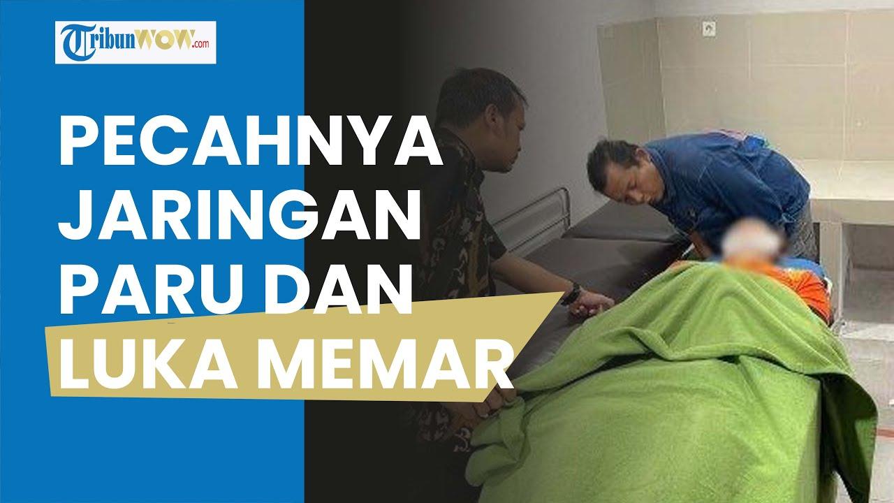 hasil-autopsi-jenazah-taruna-stip-korban-penganiayaan-senior.jpg
