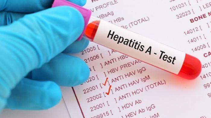 hepatitis-a.jpg