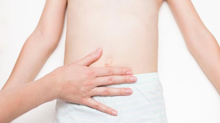 Benjolan di Pusar atau Lipatan Paha Anak Muncul Lalu Hilang, Benarkah Itu Hernia? 