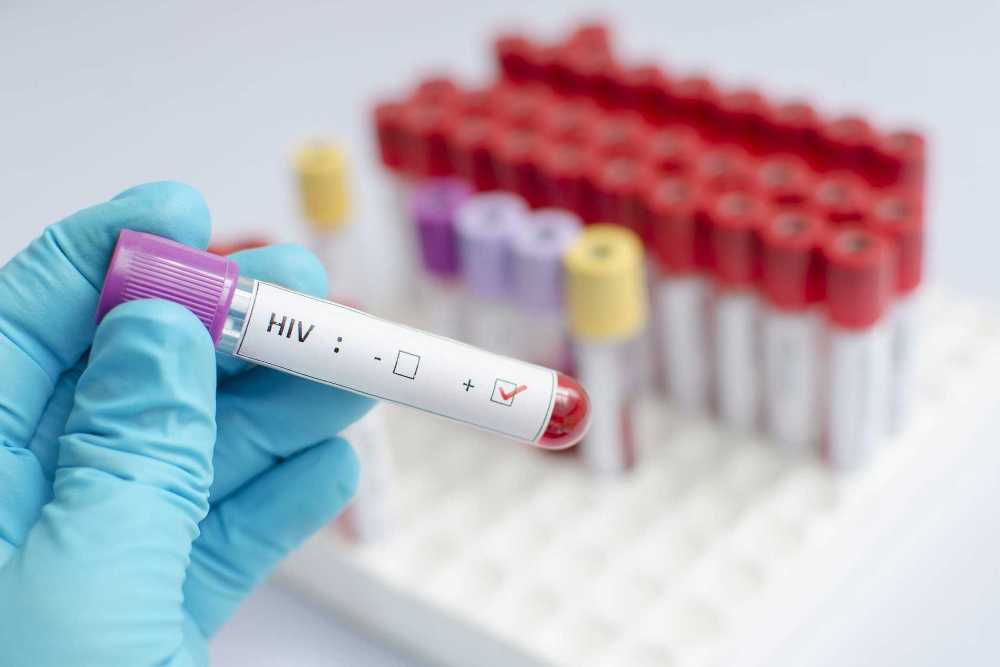 ilustrasi-hivaids_20161206_064516.jpg