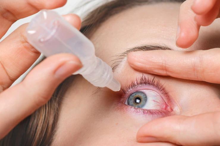 ilustrasi-obat-tetes-mata-freepik.jpg