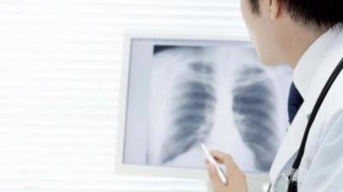 ilustrasi-pneumonia.jpg