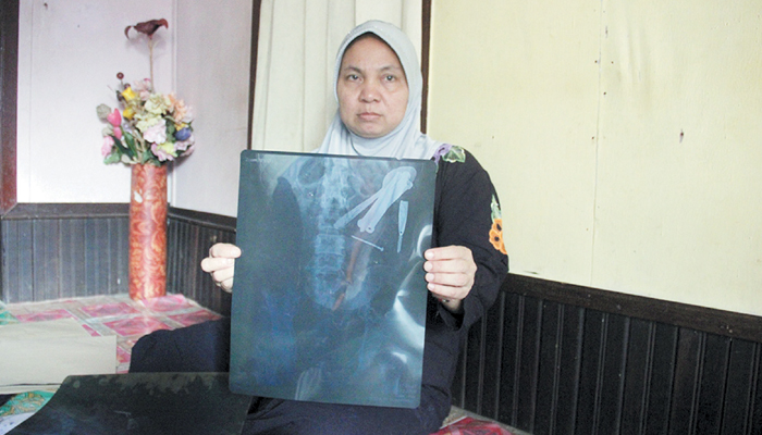 jumrah-menunjukkan-hasil-rontgen-anaknya-jahrani_20180223_080517.jpg