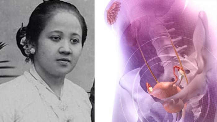 kartini-preeklampsia.jpg