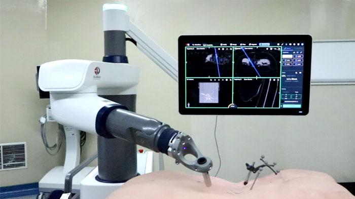 kecanggihan-teknologi-yang-dimiliki-eka-hospital-robot-navigasi.jpg