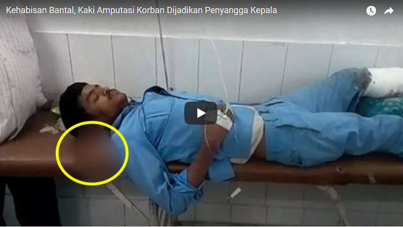 kehabisan-bantal-kaki-amputasi-pasien-rumah-sakit-ini-dijadikan-penyangga-kepala_20180314_180711.jpg