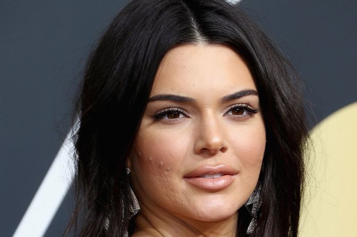 kendall-jenner-jerawat_20180109_135144.jpg