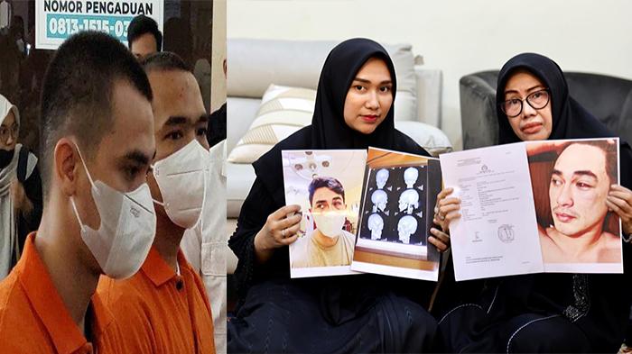 kolase-septia-siregar-dan-ibunda-rico-valentino-sebut-ada-belasa-orang-keroyok-rico.jpg