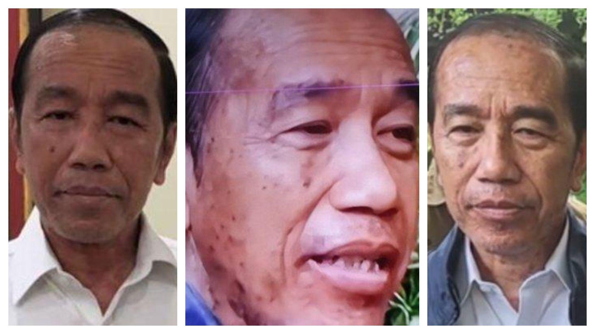 Kondisi Jokowi Setelah Alergi Kulit: Wajah Ada Bercak Putih, Warna ...
