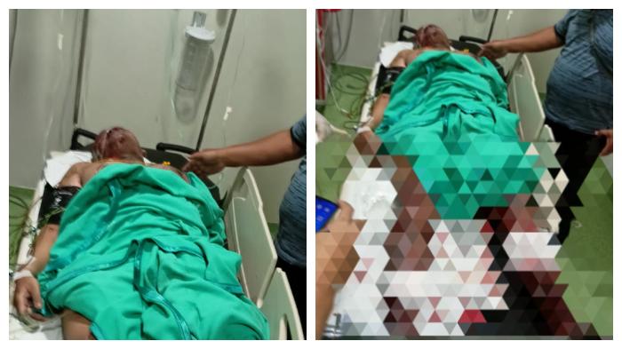 ledakan-di-grogol-sukoharjo-satu-anggota-polri-jadi-korban.jpg