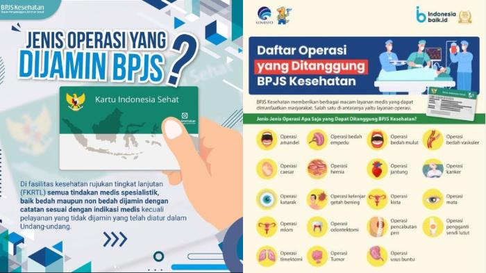 operasi-bpjs-kesehatan.jpg