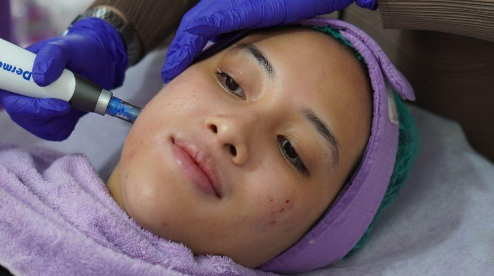 perawatan-baby-stem-healer-bagian-perawatan-cell-therapy-menggunakan-sekretome.jpg