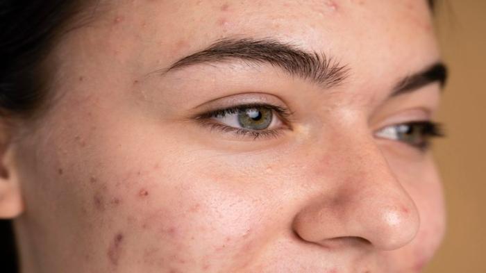 skin-barrier-rusak_5.jpg