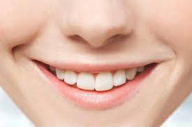 smyle-ok_20170511_103402.jpg