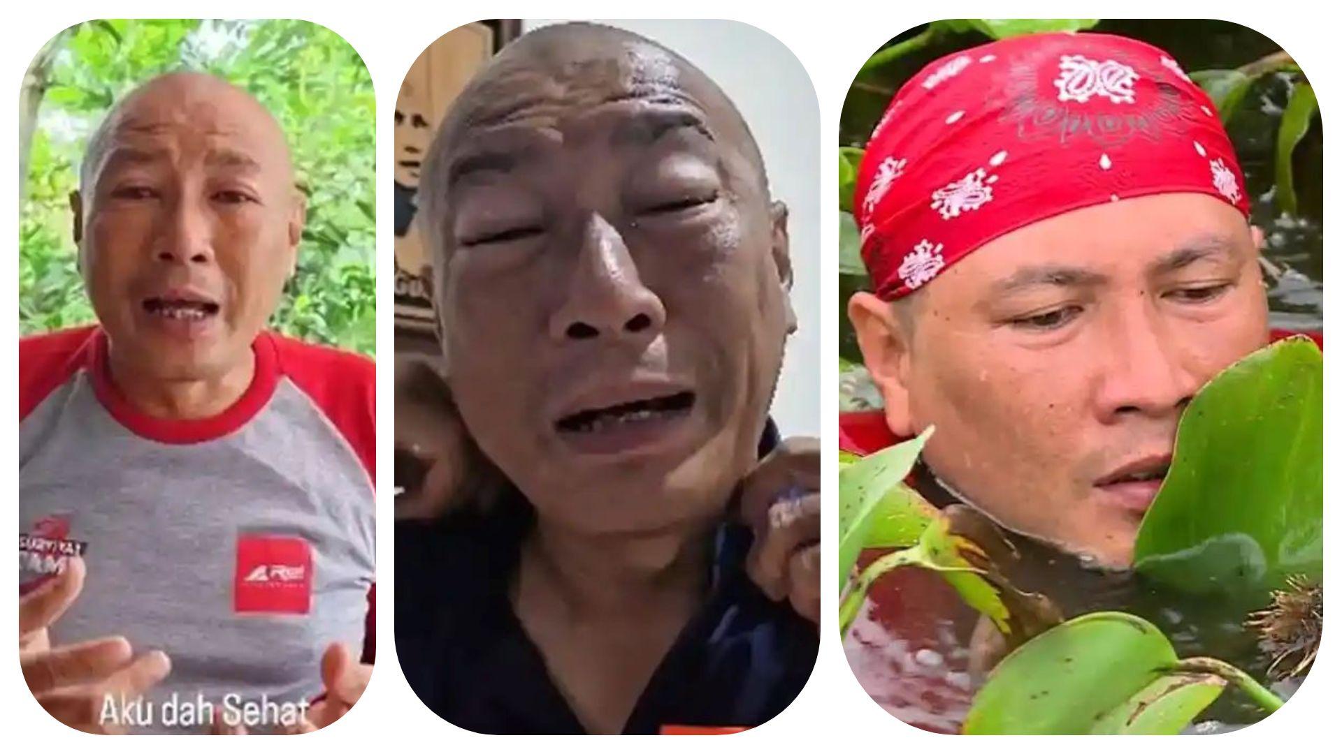 sosok-si-gundul-kena-bisa-ular-cobra-mata-bengkak.jpg