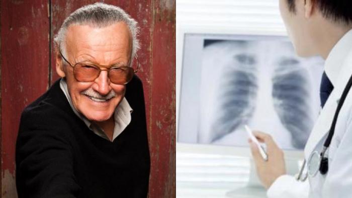 stan-lee-dan-penyakit-pneumonia.jpg