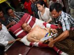 20130430_Korban_Luka_Tembak_Kerusuhan_Musi_Rawas_2834.jpg