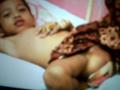 20131212_142936_bocah-penderita-tumor-ganas.jpg