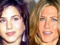 20140102_181608_wajah-jennifer-aniston-sebelum-dan-sesudah-operasi-bedah-plastik.jpg