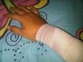 20140104_095402_tangan-terluka.jpg