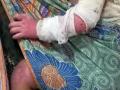 20140106_123752_bayi-disiram-air-panas-oleh-ayahnya.jpg