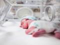 20140110_171847_bayi-prematur.jpg