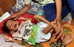 20140112_230741_bayi-gizi-buruk-di-makassar.jpg
