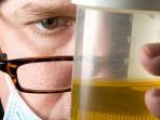 20140313_151925_urine.jpg