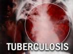 20140319_150329_tuberculosis1.jpg