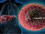 20140715_223749_hepatitis.jpg