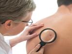 20140904_174535_kanker-kulit-skin-cancer.jpg