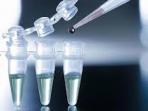 20140920_110153_stem-cell1.jpg