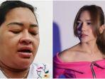 5-fakta-selebgram-ella-nanda-tewas-usai-sedot-lemak-kronologi-pembuluh-darah-pecah-kata-keluarga.jpg