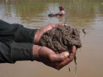 Hasil Rontgen Bocah Cacingan di Bengkulu: Banyak Cacing Gelang di Usus Halus dan Besar