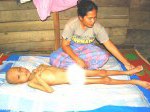 Bocah-Gizi-Buruk.jpg
