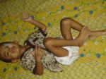 Haidar-penderita-tumor-langka.jpg