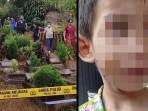 Cara Ibu Tiri di Bogor Tutupi Aksi Kejamnya Siksa Anak Sambung, Pakaikan Bedak untuk Samarkan Memar