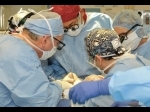 OPERASI-CANGKOK-WAJAH-face-transplant.jpg