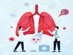 Rentosertib: Terobosan Pengobatan Fibrosis Paru Idiopatik Berkat Kecerdasan Buatan