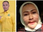 Komentar Sosmed soal 'Hubungan' Ketua DPRD Sumut-Bobby hingga Wakil Ketua DPRD Deliserdang Tersangka