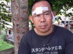 agus-sumpena-korban-penembakan-salah-sasaran.jpg